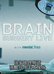 清醒开颅手术现场