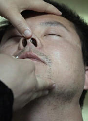这个办法治鼻炎，一针见血